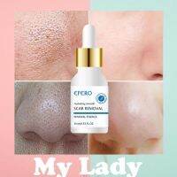 Mylady888 EFERO เอสเซนส์ลดสิว code037 Efero Acne removal Face Cream Repair Essence Whitening Cream Black dot Spotเซรั่มดูแลผิวหน้า