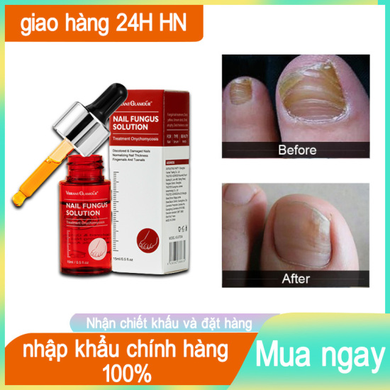 Vibrant glamour dưỡng móng tay dài và cứng nail repair serum fungal nail - ảnh sản phẩm 1