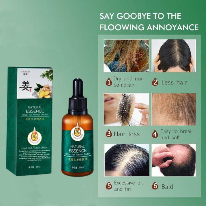 Hair Growth Serum Ginger Hair Treatment Essence Anti Hair Loss Spray