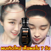 PEIMEI ขิงช่วยป้องกันผมร่วง 250ML เร่งผมเกิดใหม่ ผมยาวไว ป้องกันผมล่วง แชมพูสำหรับลดผมขาดหลุดร่วง (แชมพูแก้ผมร่วง ยาสระผมแก้ร่วง แชมพูสมุนไพร แชมพูขิงเพียว สูตรเข้มข้นพิเศษ สกัดจากขิงสด รากผมแข็งแรง แชมพูปลูกผม ทรีทเมนต์ผมล่วง)