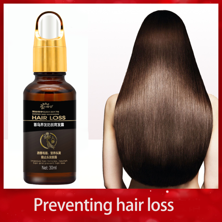 頭發精油生發水Natural herbs hair growth serum 30ml Hair Treatments hair tonic ...