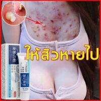 Dr.LeDun ครีมลดสิว 20g รอยแดง รอยดำจากสิว ดูดซับอย่างรวดเร็ว ดูดซับความมันส่วนเกิน ครีมแก้ฝ้า สิวหายถาวร ครีมแต้มสิว