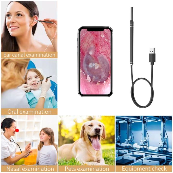 smart-ear-cleaner-endoscope-spoon-camera-ear-picker-cleaning-wax-removal-visual-earpick-wifi-mouth-nose-otoscope-support-android