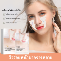 พร้อมส่ง แผ่นแปะร่องจมูก ยกกระชับผิวที่ร่องแก้ม มากส์แปะริ้วรอย แผ่นแปะร่องแก้ม แผ่นแปะริ้วรอย แผ่นลดริ้วลอย กล่องละ 5 คู่ ปรับปรุงริ้วรอยอย่างล้ำลึก แผ่นลดริ้วรอยร่องแก้ม แผ่นลบเลือนริ้วรอย แผ่นมากส์ร่องแก้ม แผ่นแปะริ้วรอย