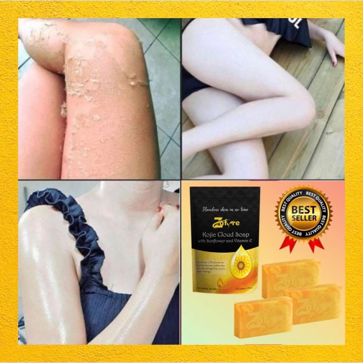 SETS of Zafyre kojic cloud soap with sunflower oil  vitamin e, flawless  skin in no time, kojic soap original, body soap, whitening soap effective  just days soap whitening
