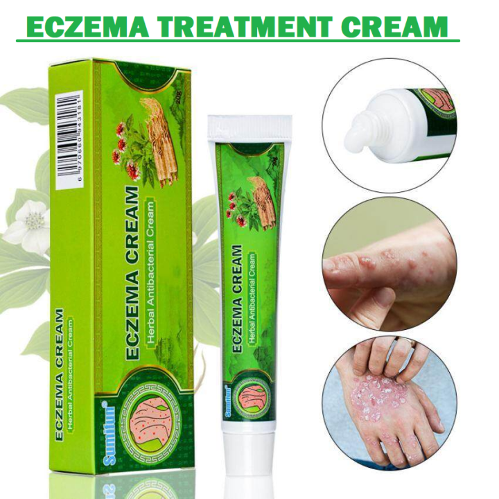 (20g) SUMIFUN ECZEMA TREATMENT CREAM DERMATITIS CREAM PSORIASIS