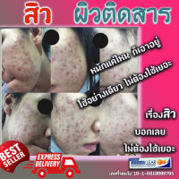 dermaspotklear 15g. สิว ดูแลสิว รอยสิว ผิวหน้าชุ่มชื่น แข็งแรง สูตรลดสิว ช่วยควบคุมความมัน บอกลาปัญหาสิว คืนความมั่นใจ หลักฐานมี รีวิวเพียบ