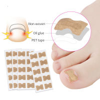 【2023】Ingrown Toenail Corrector สติกเกอร์ Paronychia Treatment Pedicure Toe Nail Care Corrector Patch Correction สติกเกอร์10-50Pcs