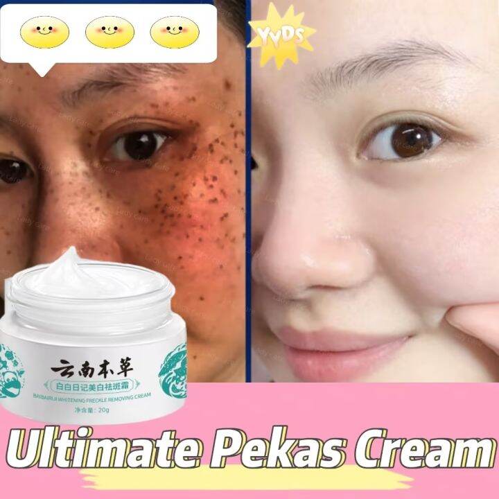 Japanese Melasma Cream Yunnan Herbal Whitening Freckle Cream Japanese Melasma Cream Original