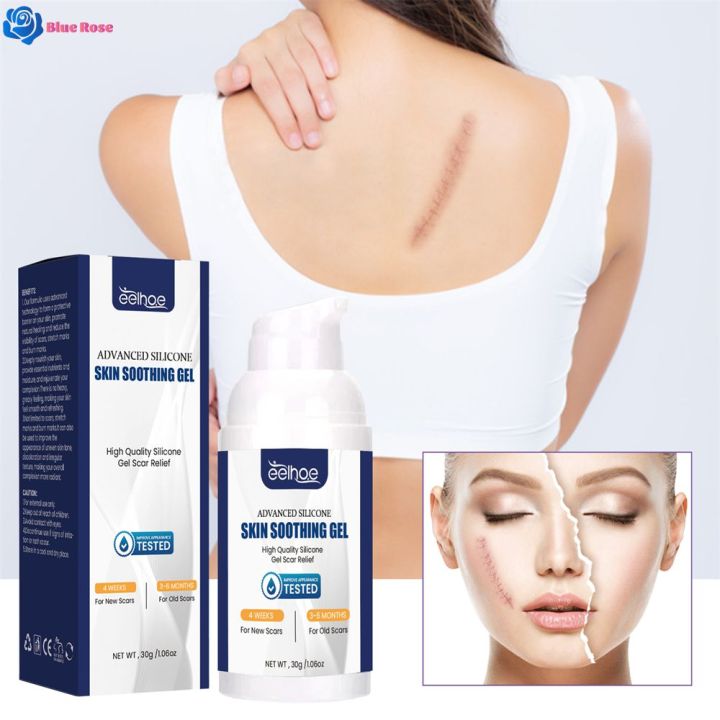 Blue Rose EELHOE Scar Desalination Gel Scar Repair Surgery Scar ...