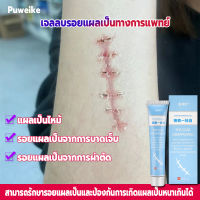 ผลลัพธ์ที่รวดเร็ว Puweikeเจลทารอยแผลเป็น20g เร่งการรักษาผิว กำจัดรอยแตกลาย แผลไฟไหม้ ครีมทารอยสิว แผลผ่าตัด ครีมทารอยแผลเป็น ครีมลบแผลเป็น ยาลบลอยแผลเป็น