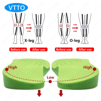 VTTO O/ X-Leg Orthopedic Insoles Arch Support Insole Corrigibil Bow ขา Valgus Varus นวดแผ่นรองเท้าความงามขา Feet Care