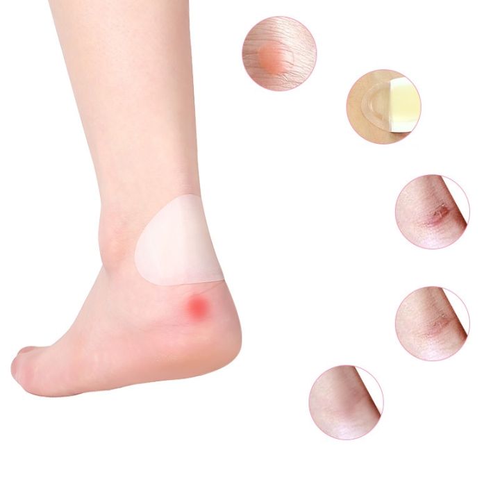 foot-blister-protection-blister-bandaid-for-feet-blister-patches-heel-protector-toe-seal-adhesive-blister-pads-blister-gel-guard