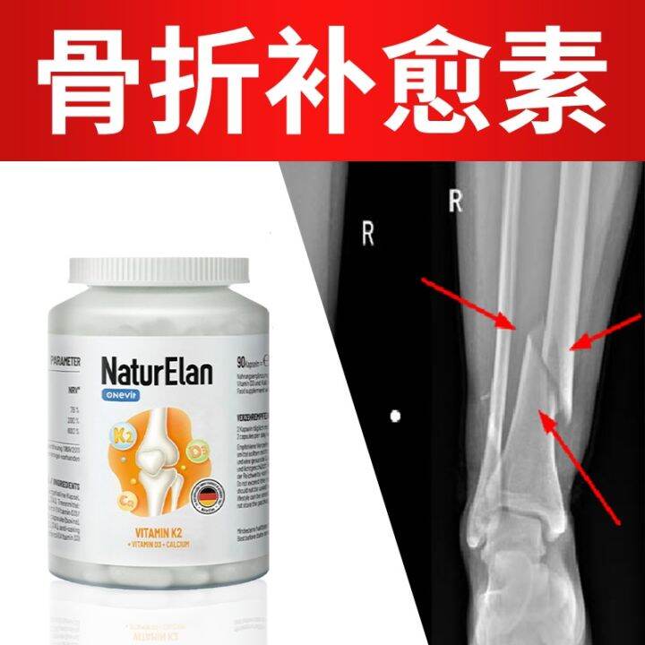NATURELAN strong bone supplement calcium capsule k2d3 calcium imported from Germany calcium