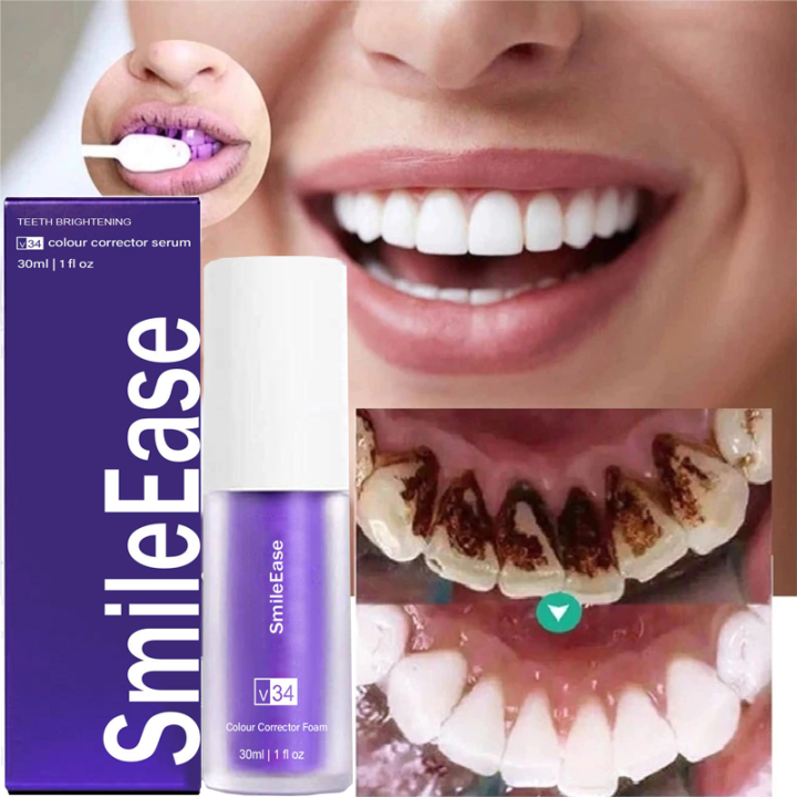 Smile Ease TOOTHPASTE V34 Teeth Whitening Toothpaste Stain Removal ...