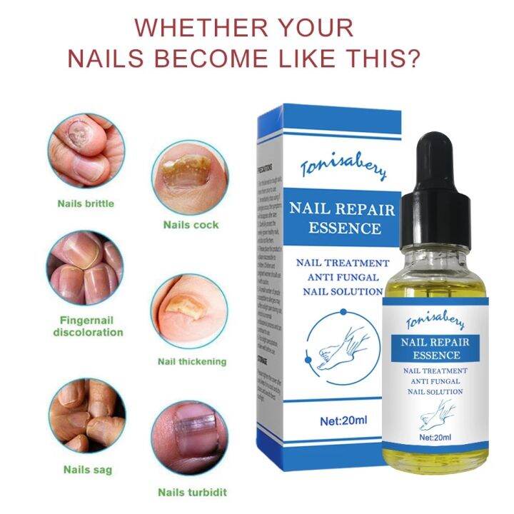 20ml-nail-fungus-repair-fluid-treatment-foot-care-essence-nail-foot-care-toe-nail-fungus-removal-gel-anti-infective-paronychia