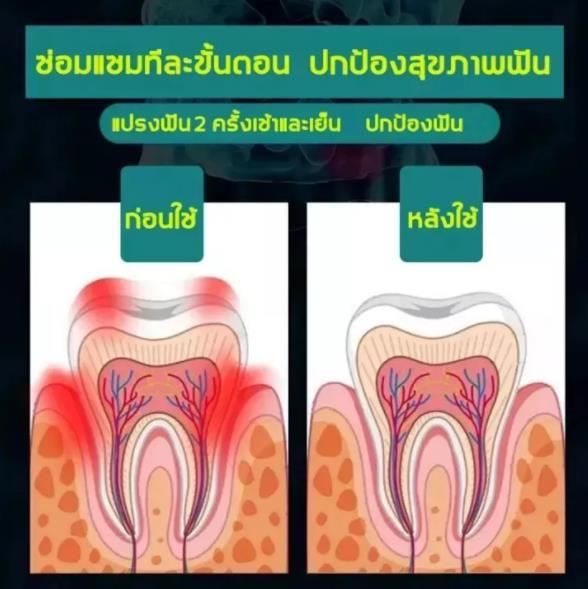 ลดฟันเหลือง-ป้องกันฟันผุ-ยาสีฟันน้ำผึ้งธรรมชาติ-bangchiling-ลดหินปูน-คราบฟัน-ปวดฟัน-มูสฟอกฟันขาว-ยาสีฟันน้ำผึ้ง-ยาสีฟันฟอกขา-ยาสีฟัน-ยาสีฟันขจัดปูน-ฟันผุ-ยาสีฟันฟันขาว-ปวดฟันผุ-ฟันขาว-น้ำยาขัดฟันขาว-ย