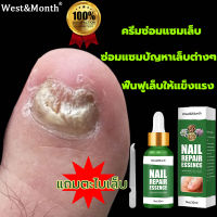 【ส่งจากไทย】West&amp;Monthเชื้อราเล็บมือ  บำรุงเล็บ ดูแลเล็บ น้ำยารักษาเล็บ รักษาเล็บเสีย น้ำยาล้างเล็บ เซรั่มบำรุงเล็บ เซรั่มรักษาเล็บ รักษาเล็บ น้ำมันบำรุงเล็บ เอ็สเซ้น ซ่อมแซมเล็บเสีย ครีมบำรุงเล็บ เซรั่มซ่อมแซมเล็บ ทาเชื้อราที่เล็บ Nail Repair Essence