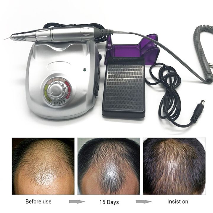 hair-follicle-transplantation-equipment-hair-grown-transplant-implanter-fue-beauty-tools-hairline-eyebrows-hair-regrowth