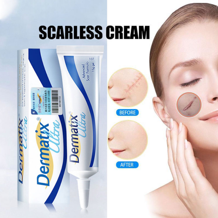 Dermatix Effective Scar Removal Cream Scar Gel Old Scars Acne Skin