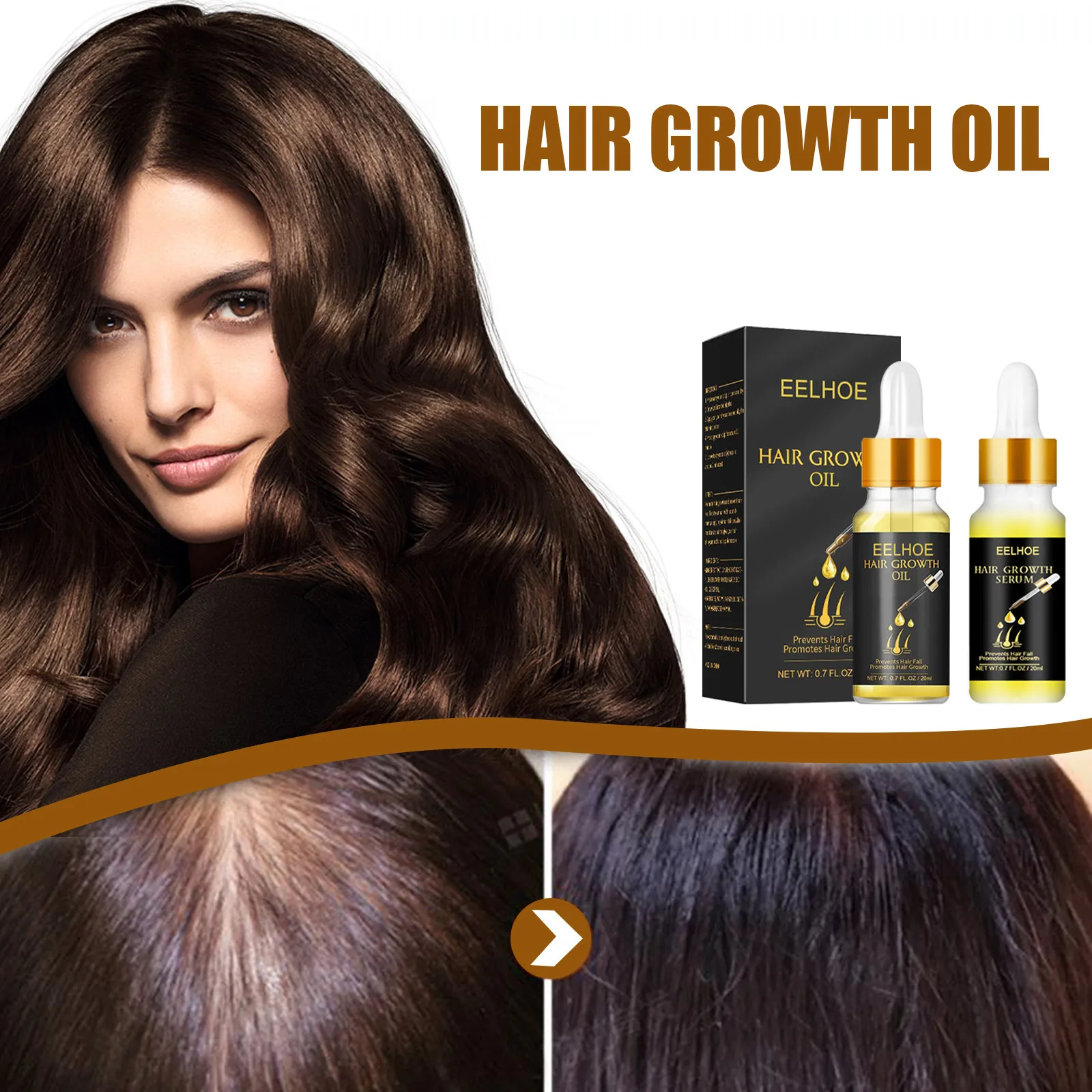 Hair Growth Essential Oil Scalp Treatments Fast Effective Hair Grow  Restoration Regeneration Serum Thick Strong Anti Drying Anti Hair Loss  Prevent Baldness Hair Care 20ml | Lazada PH