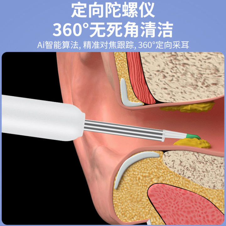 pdd-ที่แคะหูสำหรับเด็กความละเอียดสูงเครื่องมือเก็บภาพอัจฉริยะเลือกการแสดงภาพทางการแพทย์