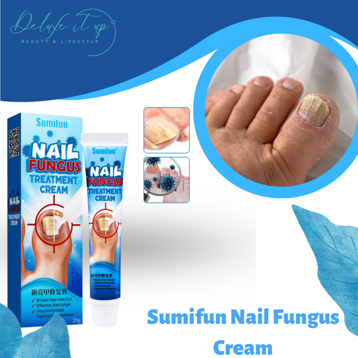 Antibacterial Cream Anti Fungal Cream Nail Fungus Treatment Paronychia ...