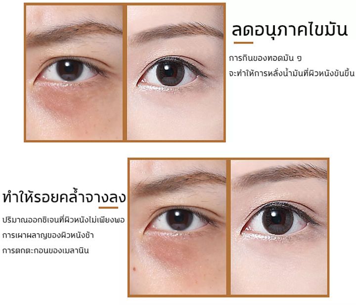 cycy-อายครีมบำรุงตา-30g-ใต้ตาขับไล่รอยคล้ำใต้ดวงตา-ถุงใต้ตา-ริ้วรอย-รอยตีนกา-ริ้วรอยร่องแก้ม-ลด-ริ้วรอย-ต่อต้านริ้วรอย-ผิวดูกระจ่างใส-ครีมทาถุงใต้ตา-ครีมบำรุงรอบตา-ครีมทาใต้ตา-ครีมทาตา-ครีมลบถุงใต้ตา-