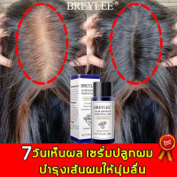 จัดส่งทันที ทำให้รากผมแข็งแรง เซรั่มบำรุงผม แก้ปัญหาผมร่วง  BREYLEE  บอกลาหัวล้าน เซรั่มแก้ปัญหาผมร่วง เซรั่มบำรุงผม ทรีนเมนบำรุงผม  เซรั่มบำรุงรากผม  ป้องกันผมร่วงอย่างมืออาชีพ  เร่งผมยาวไว  เหมาะกับทุกปัญหาผมร่วง   เซรั่มปลูกผม 20ml