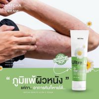 ของแท้ 100% Natcha Ultra U นัชชา อัลตร้ายู ครีม ลดปัญหาผิว (30 g) เก็บโค๊ดส่งฟรี