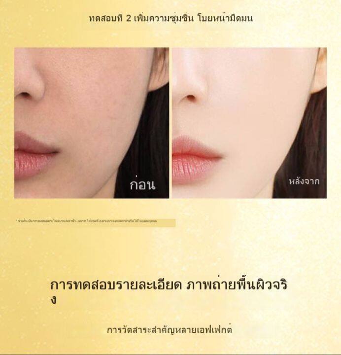 เซรั่มหน้าเด้ง-ผลิตภัณฑ์บำรุงผิวหน้า-youth-freezing-fairy-nutrition-lotion-เซรั่มนเำตบทองคำ-ผิวสวยเนียนใส-4012