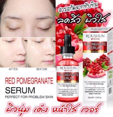 ROUSHUN Skin Care Red Pomegranate Serum. ขนาด 30ml. เซรั่มทับทิม ลดจุดด่างดำ รอยแผลเป็นจากสิว**ของแท้ พร้อมส่ง