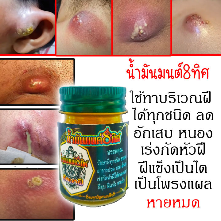 ครีมทาฝี-หัวฝีหนอง-หัวฝีอักเสบ-ฝีแตก-ฝีที่อยู่บนผิวหนังตามร่างกาย-ตราน้ำมันมนต์8ทิศ-กระปุกใหญ่-ออร์แกนิก