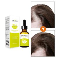 【cw】 Hair Care Treatment Essential Oil Prevent Hair Loss Repairs Damage Restore Soft Oil Care of Hair Product for Women Men 10ml