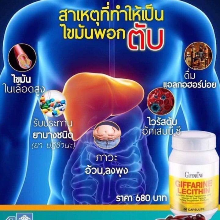 ส่งฟรี-อาหารเสริม-เลซิติน-lecithin-บำรุงตับ-สมอง-หัวใจหลอดเลือด-ลงพุง-เพลีย-ทำงานหนัก-มี-วิตามินอี-vitamin-e-60-แคปซูล-giffarine-กิฟฟารีน-ของแท้