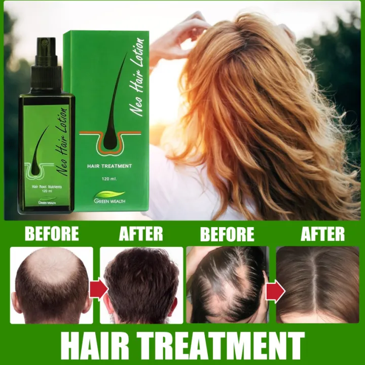 Neo Hair Lotion Herbs 100 Natural Treatment Spray Stop Hair Loss Root BEARD SIDEBURNS LONGER