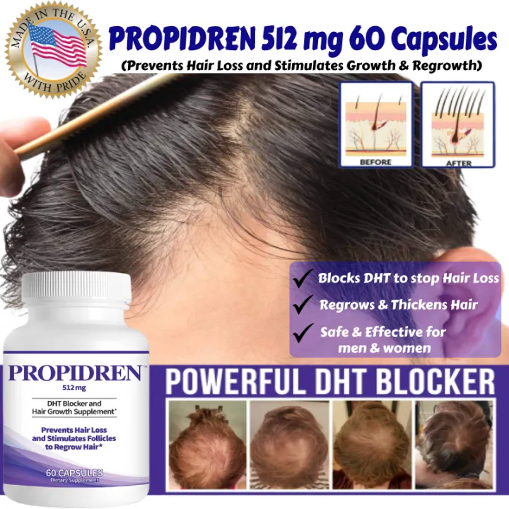Propidren 💪 DHT Blocker with Saw Palmetto 💪 Complement Rogaine / Regaine  👍 Stop Hair Loss 👍 Stop Baldness 👨 Regrow Hair | Lazada Singapore