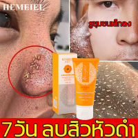 HEMEIEL   มาส์กกำจัดสิวหัวดำ ลอกสิวเสี้ยน  กำจัดสิวเสี้ยน มาส์กชาโคล ทำความสะอาดผิวหน้า