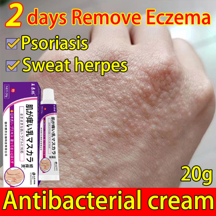 Japan👍 Antibacterial Cream 20g 3 Seconds To Relieve Itching Sweat