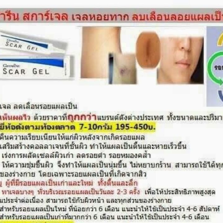 ส่งฟรี-กิฟฟารีน-ครีมลบแผลเป็น-ครีม-ครีมกำจัดรอยแผลเป็น-เจล-รอยแผลเป็น-สการ์เจล-กระตุ้น-การสร้าง-คอลลาเจน-รอยแผลเป็น-กิฟฟารีน-ของแท้