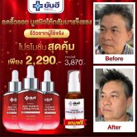 Yanhee Red Energy Lifting Serum [ 2 ขวด ] เรดเอนเนอจี้ตัวนี้คิดค้นสูตรมาเพื่อเน้นดูแลรักษาริ้วรอย ตีนกา ร่องลึก ร่องแก้ม ใต้ตา กอบกู้ผิวโทรม จากยันฮี ขนาด 30ml. แถมฟรี YANHEE PREMIUM SERUM 1ขวด ดูแลรักษาเเฉพาะจุด ฝ้า กระ จุดด่างดำ หน้ามัน หมองคล้ำ พร้อมส่