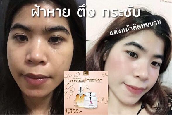 เซ็ท-lx-ไวเทนนิ่งครีม-และ-เซรั่ม-bioc-พิเศษ-ชุดละ-1300