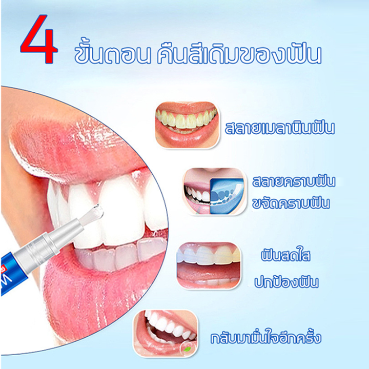 ปากกาฟัน-ฟันขาว-ฟอกสีฟัน-ปากกาฟันขาว-คราบฟัน-ปากเหม็น-น้ำยาฟอกสีฟัน-ยาฟอกฟันขาว-ฟอกฟันขาว-ที่ฟอกฟันขาว-น้ำยาขัดฟันขาว-อุปกรณ์ฟอกฟันขาว-ปากกาฟอกสีฟัน-ปากกาฟอกฟันขาว-น้ำยาฟอกฟันขาว-คราบชากาแฟ-ดูแลฟัน-เจ