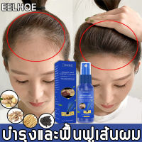 EELHOE Hair Growth สเปรย์ปลูกผม สเปรย์ปลูกผม สำหรับผมบาง เร่งผมขึ้นใหม่ เร่งผมยาวไว ป้องกันผมร่วง น้ำยาปลูกผม น้ำยาเร่งผมยาว เซรั่มปลูกผม สเปรย์เร่งผม 30ml