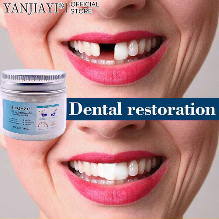 YANJIAYI 50g Temporary Tooth Repair kit for Fix denture filling solid