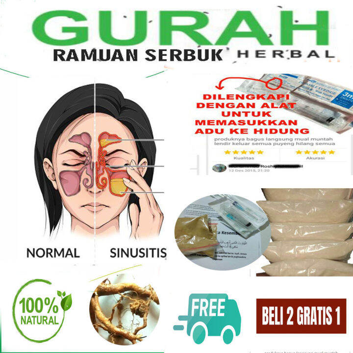 Gurah Hidung Sinusitis - Obat Gurah Lendir Dan Dahak, Obat Gurah Paling ...