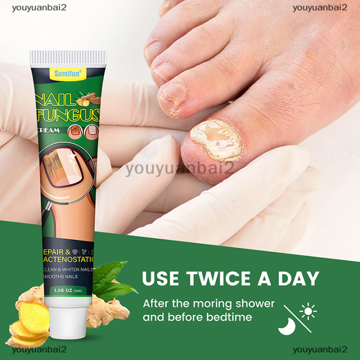youyuanbai2 Nail Fungus Treatment Cream Foot Toe Nail Fungus Removal