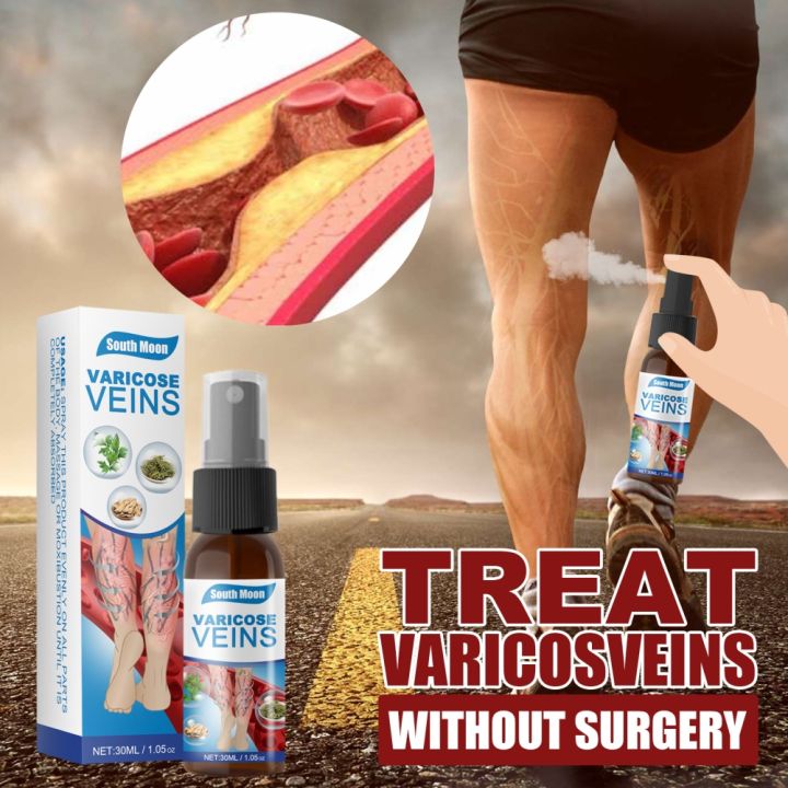 ORIGINAL VARICOSE VEINS OIL | Lazada PH