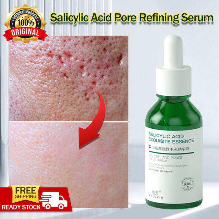 Salicylic Acid Serum】Expel acne, remove closed pimples, blackheads, oil control, fine pores