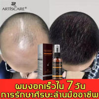 ARTISCARE เซรั่มปลูกผม เร่งผมงอกใหม่ ป้องกันผมร่วง หัวล้าน ผมบาง ช่วยให้รากผมแข็งแรง(ยาปลูกผมของแท้ ยาปลุกผมชาย เซรั่มบำรุงผม สเปรย์ปปลูก